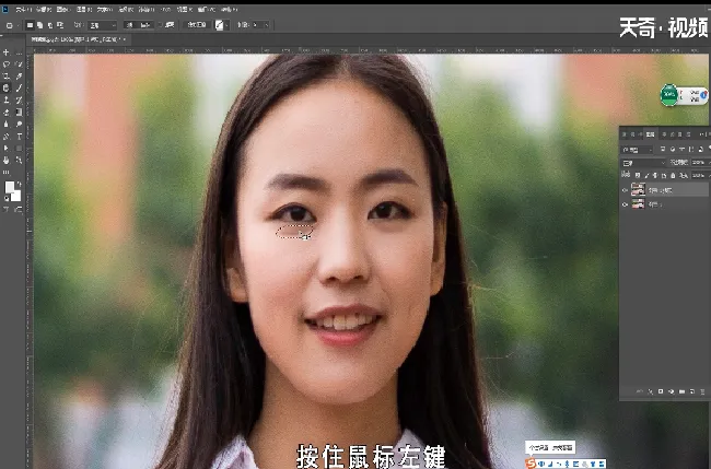 如何去眼袋