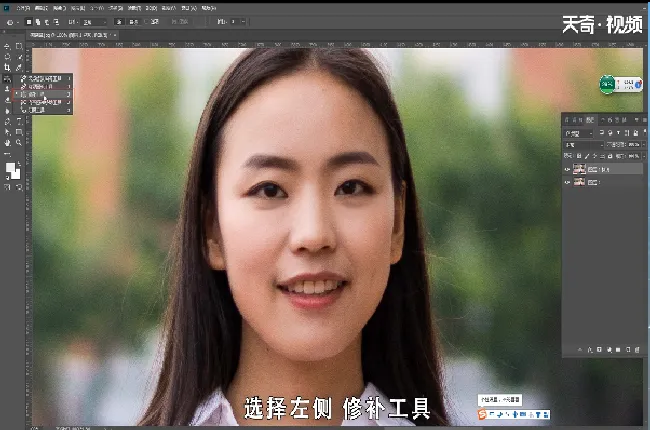 如何去眼袋