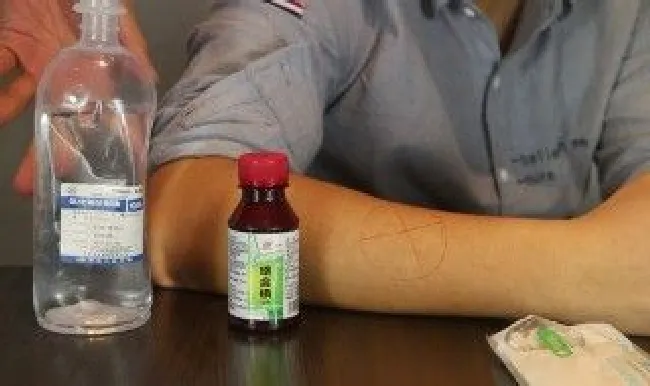 碘伏怎么清洗 床单弄到碘伏怎么清洗