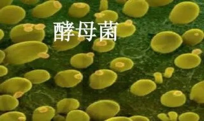 酵母菌代谢方式（酵母菌代谢方式类型）