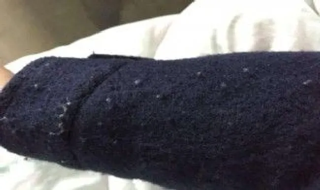怎么洗衣服才不会起球? 怎么洗衣服才不会起球不掉色