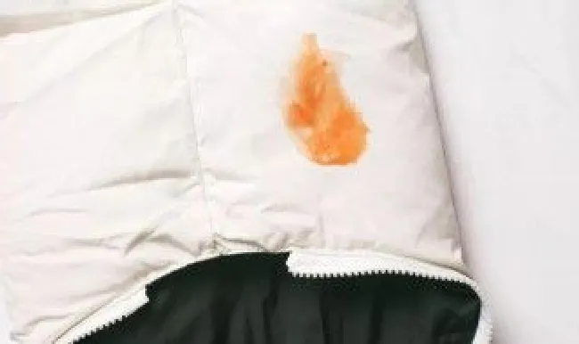 白色羽绒服表面脏了怎么擦（羽绒服送到干洗店是水洗的吗）