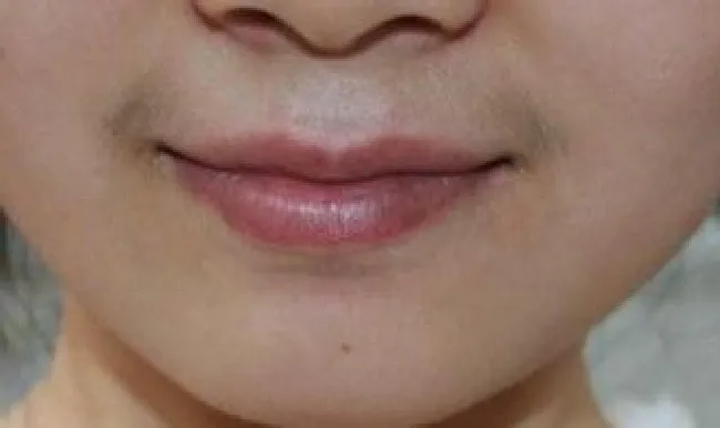 漂胡剂有什么危害