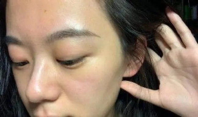 水杨酸对皮肤的作用和危害（水杨酸软膏害了多少人）
