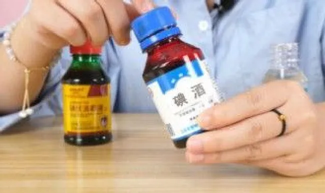 碘酒如何洗 碘酒要怎么洗