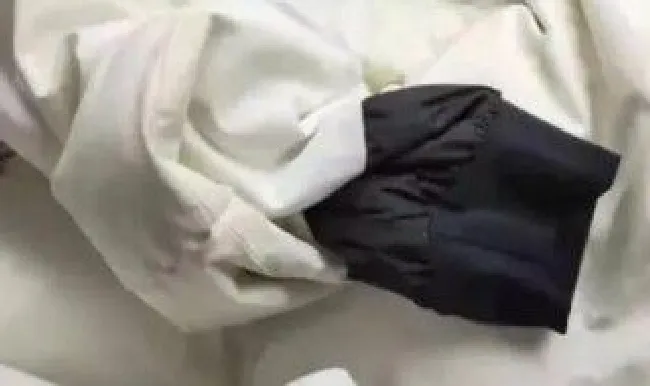 羽绒服晒得掉色能补救吗 羽绒服晒得掉色能补救吗