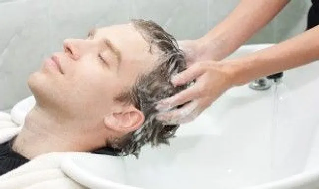 刚洗完头发就有头皮屑是怎么了 洗完头发干了就有大块头皮屑