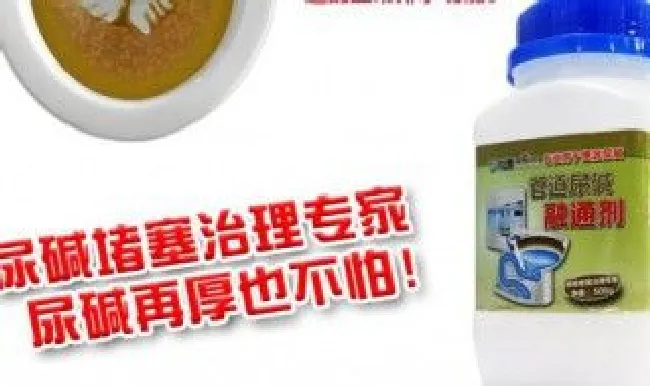 尿碱怎么去除 马桶尿碱怎么去除
