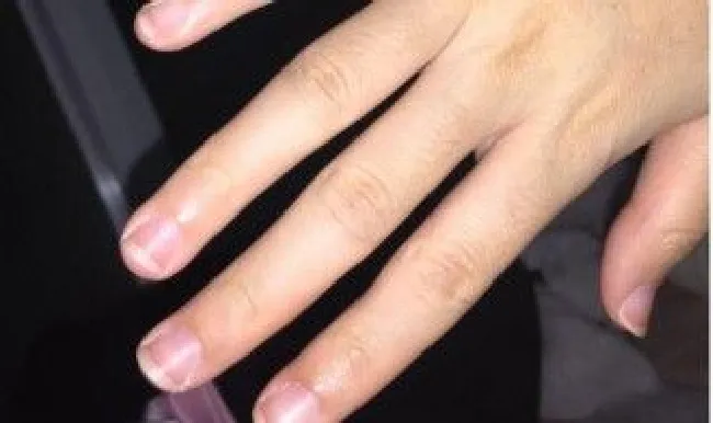 指甲又短又宽怎么改善（指甲又短又宽怎么办）